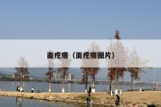 面疙瘩（面疙瘩图片）